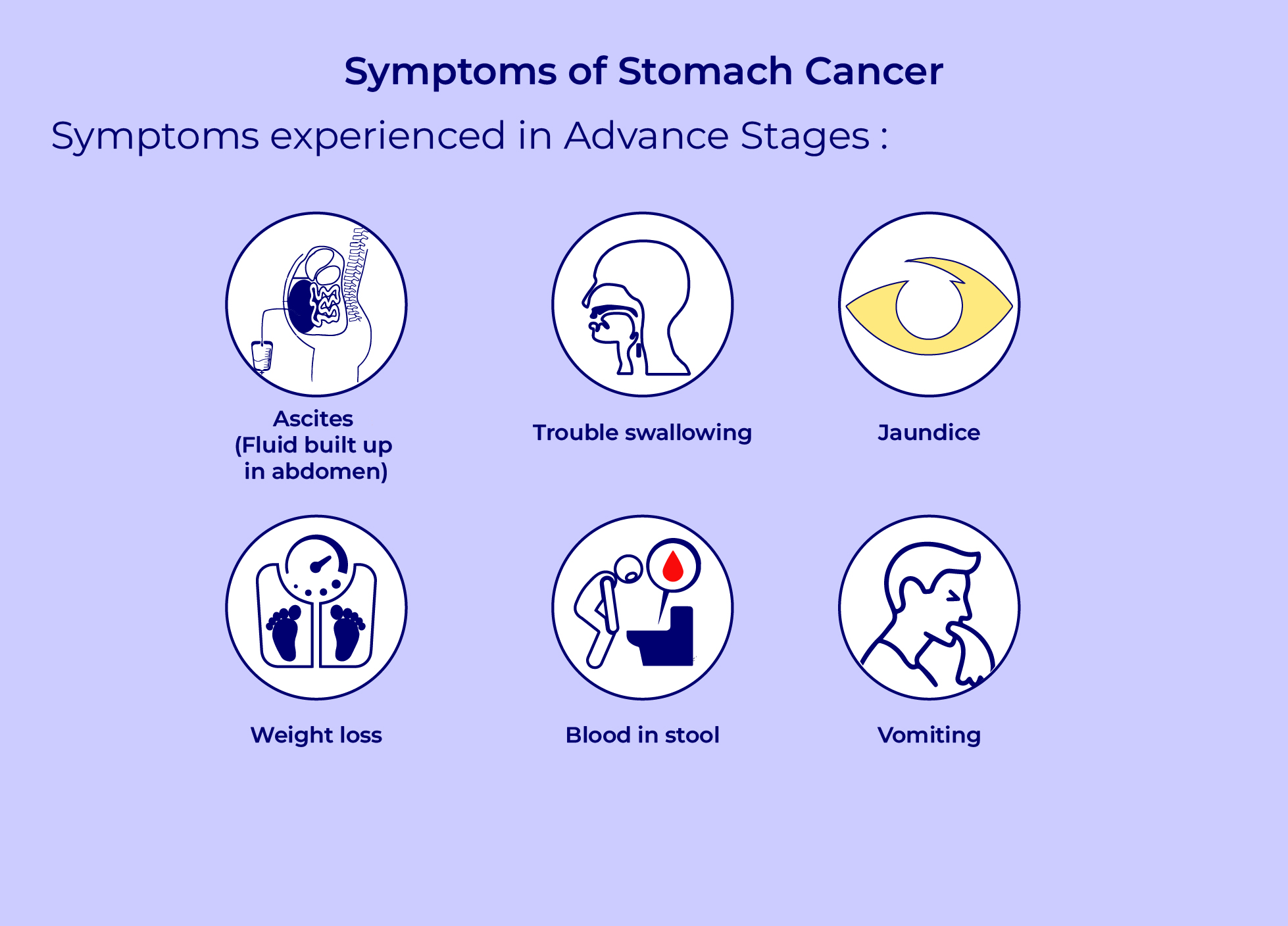 symptom-advance-stage